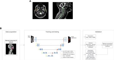 Clinical acceptance and dosimetric impact of automatically delineated elective target and organs at risk for head and neck MR-Linac patients